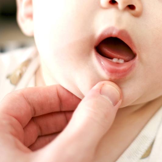 Parent helping baby do lip tie aftercare exercises