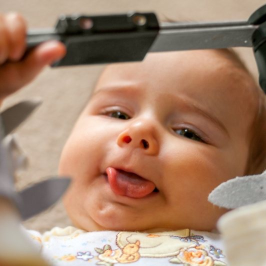 Baby smiling during frenectomy lip and tongue tie treatment process