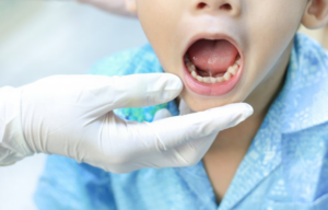 Pediatric dentist examining a child’s tongue-tie